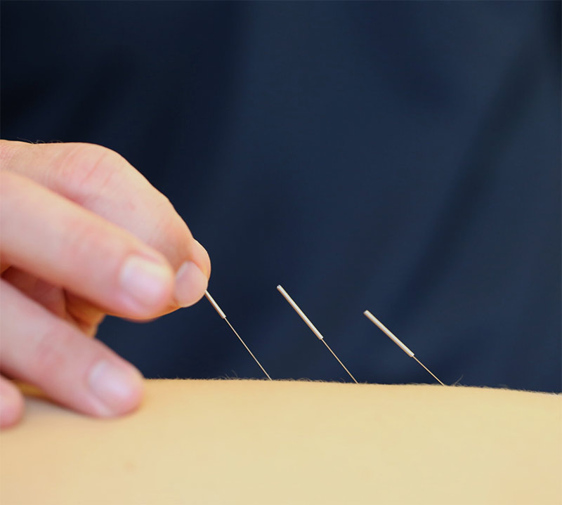 Sports Physiotherapy Brisbane